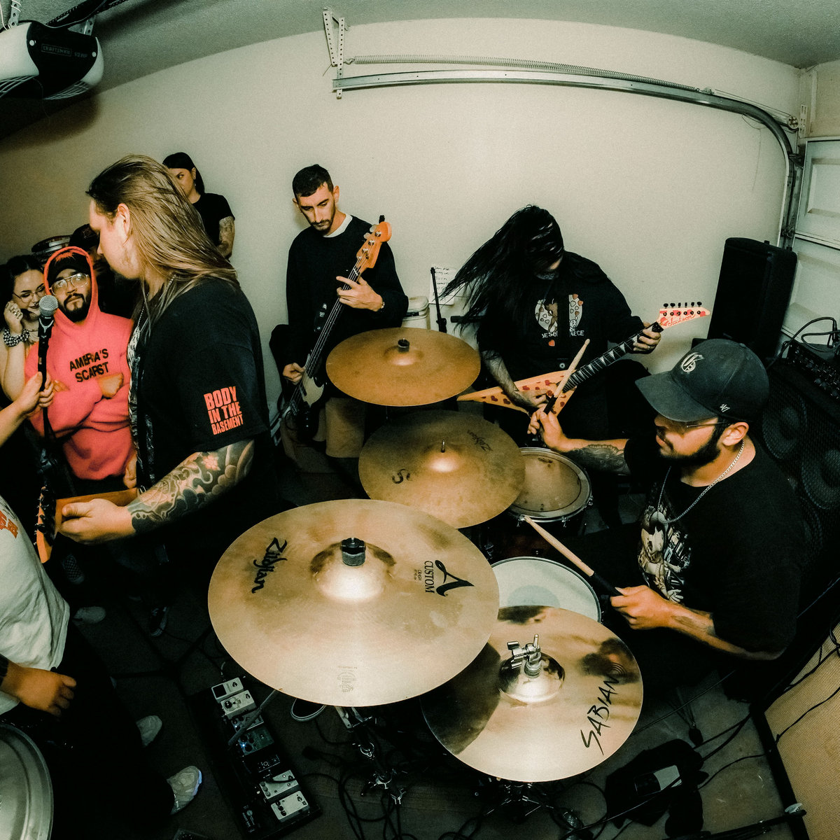 Aneurysm