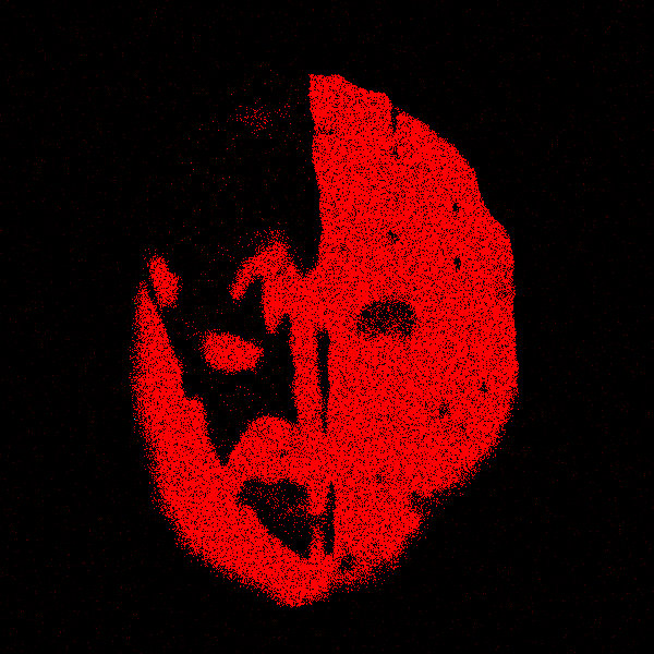 Cranial Abrasion