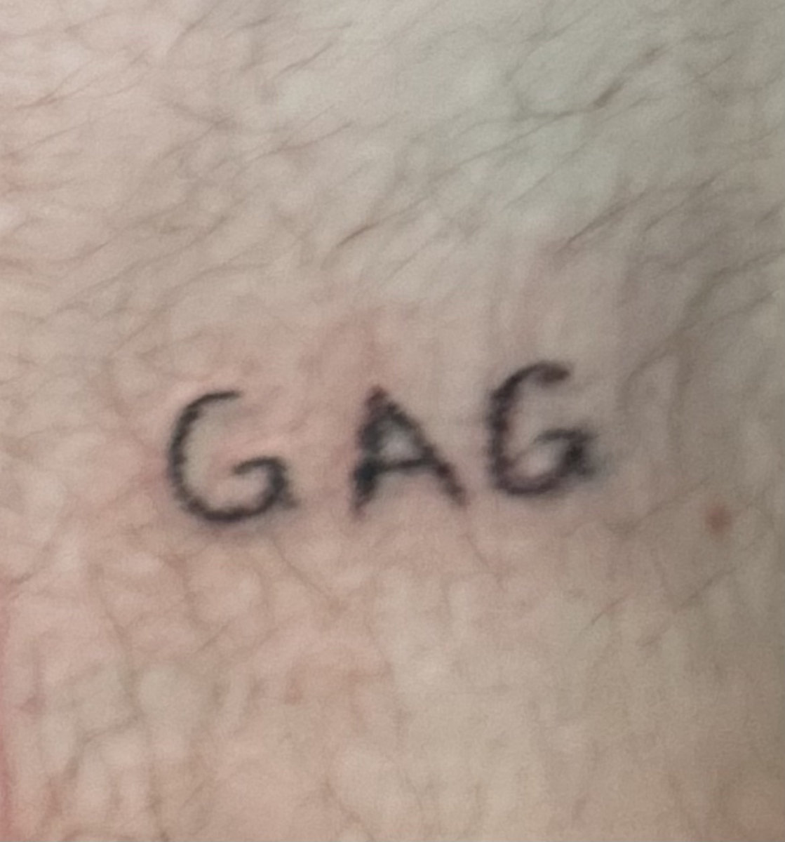 GAG