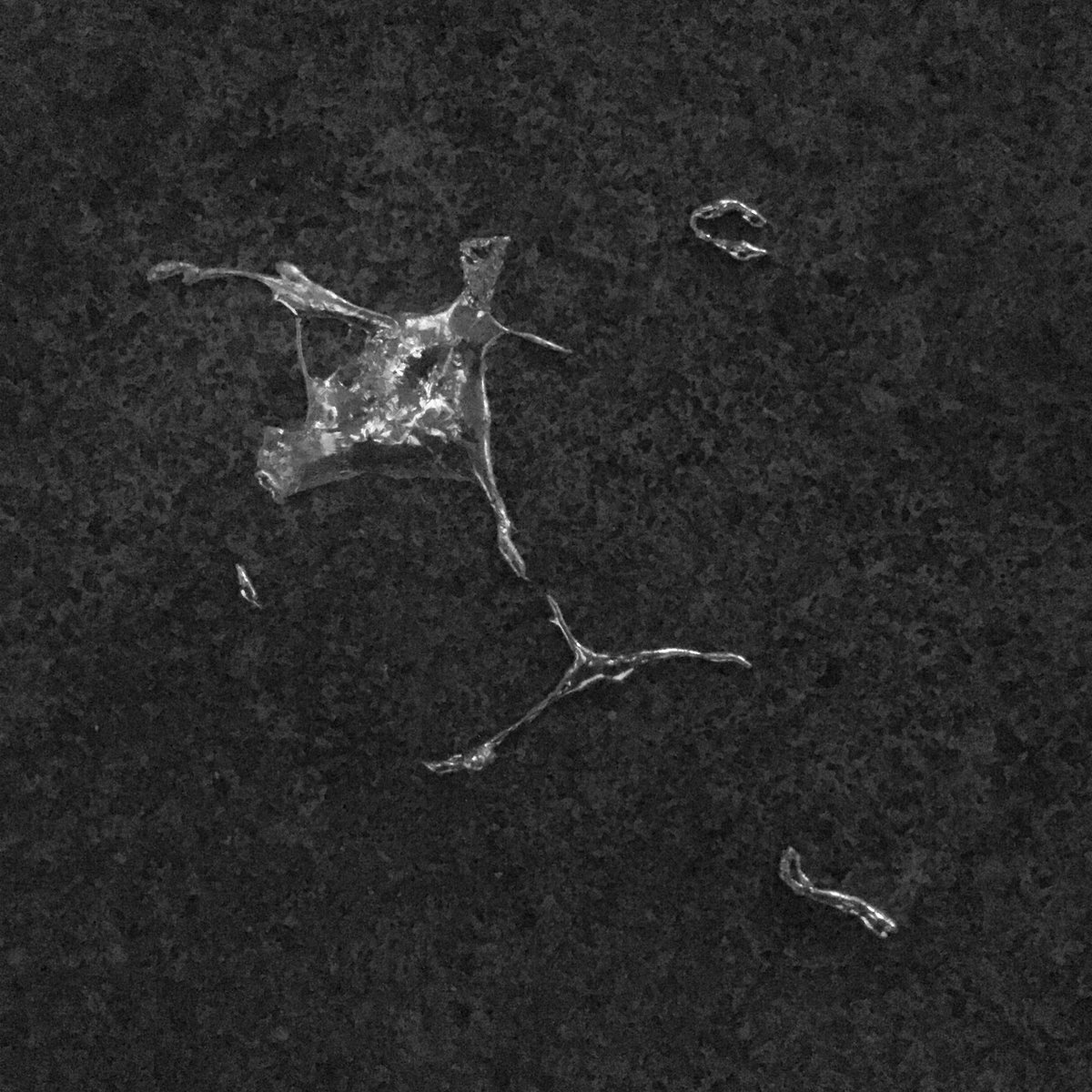 Torture & the Desert Spiders